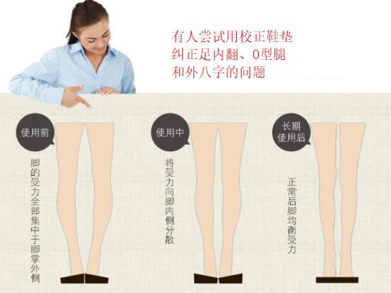 足内翻的纠正
