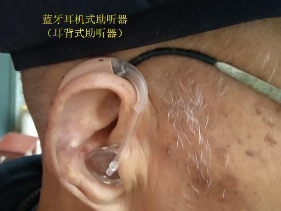 耳背式助听器