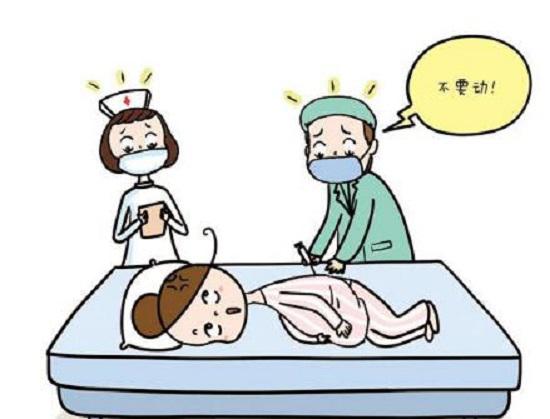 剖腹产