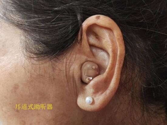 耳道式助听器