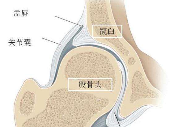 股骨头、髋臼和盂唇
