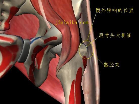 髋外弹响发生的部位