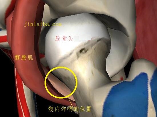 髋愉弹响发生的部位