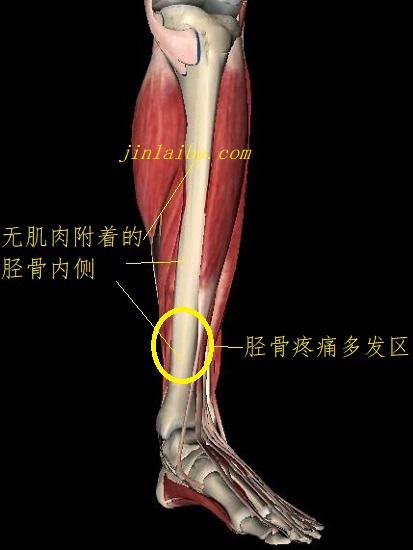 胫骨应力综合征的多发区域