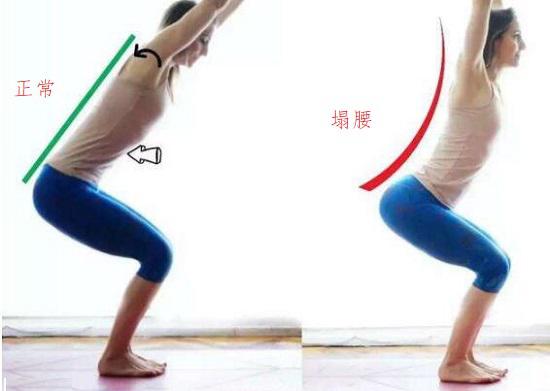 塌腰现象