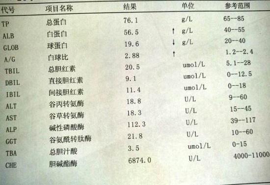 血浆中的物质（肝功能检查单）