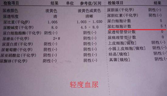 尿常规检查结果