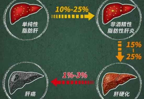 脂肪肝的恶化过程和比例