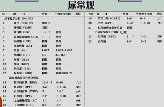 尿常规化验单