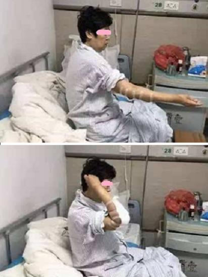 术后康复训练