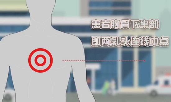 心肺复苏按压位置