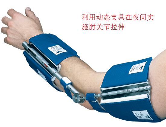 肘关节动态拉伸支具