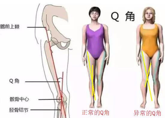 Q角