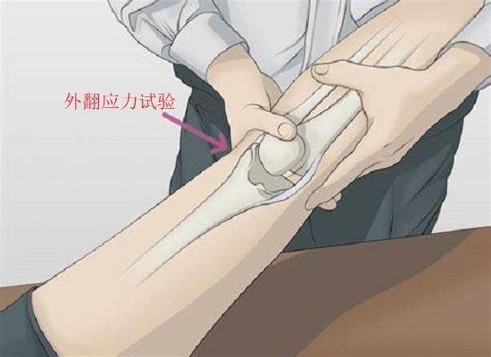 膝关节外翻应力试验