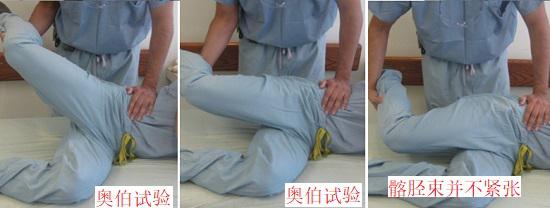 用于测试髂胫束是否紧张的奥伯试验