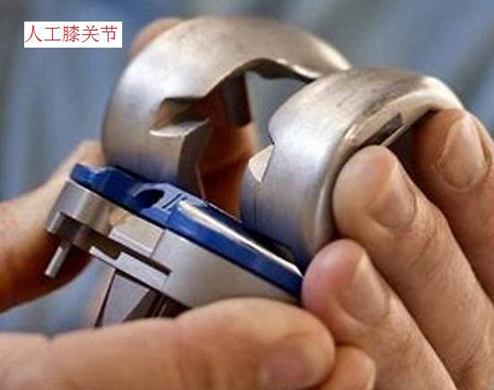 人工膝关节