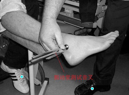用音叉进行振动觉测试