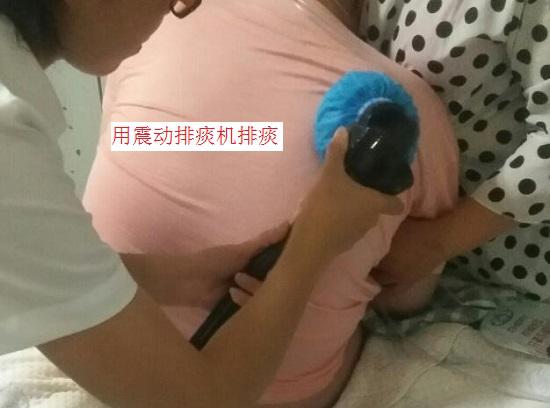 用震动排痰机排痰
