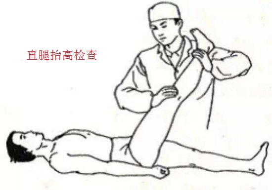 直腿抬高检查