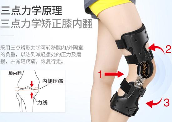 膝内翻矫形器