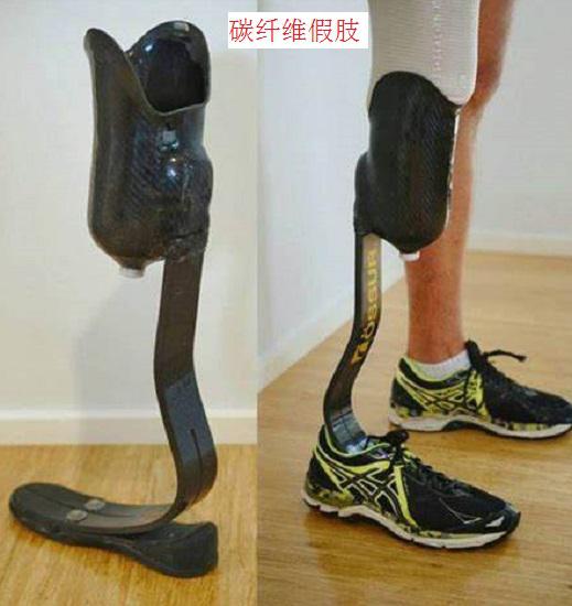 碳纤维材质的假肢
