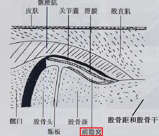 髋关节前隐窝示意图