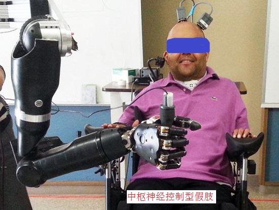 中枢神经控制型假肢