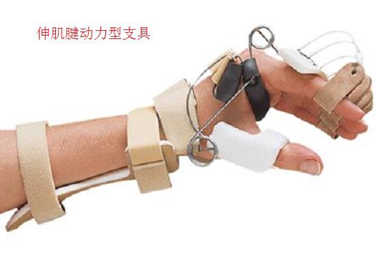 伸肌腱动力型支具