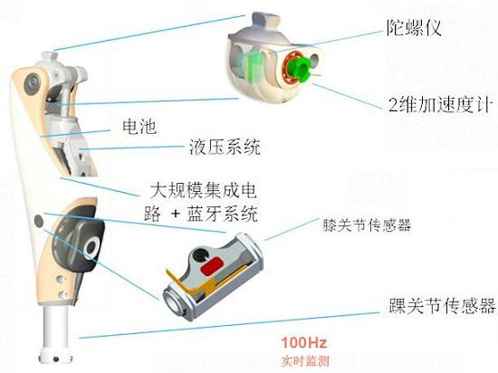 智能假肢的基本构成