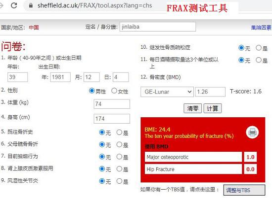 FRAX测试工具