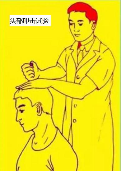 头部叩击试验