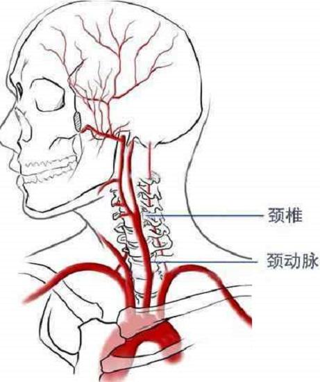 颈椎与颈动脉
