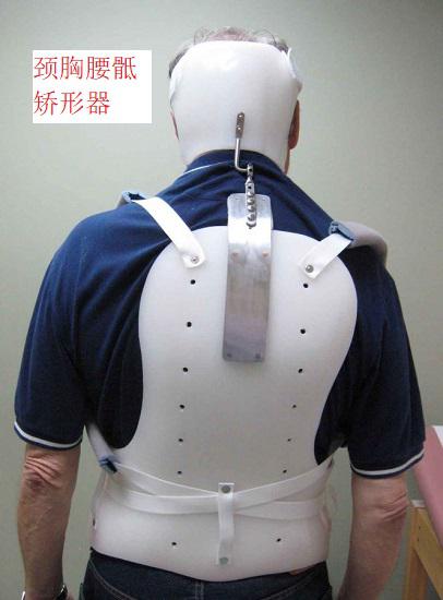 颈胸腰骶矫形器
