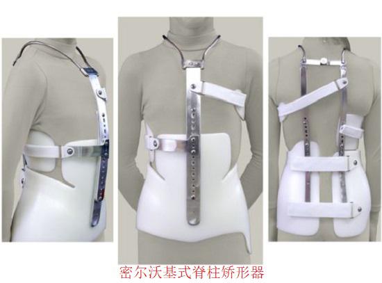 密尔沃基式脊柱侧弯矫形器