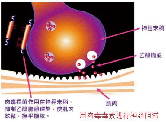 肉毒毒素的功能
