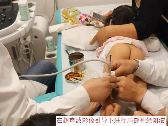局部神经阻滞的实施