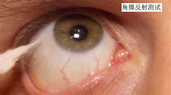 角膜反射测试