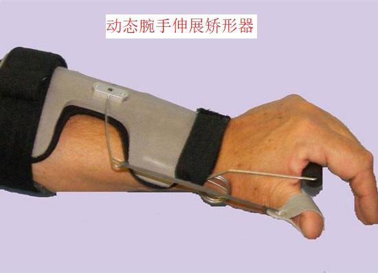 动态腕手伸展矫形器