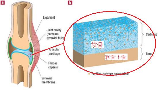 膝关节软骨