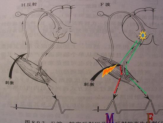 H反射