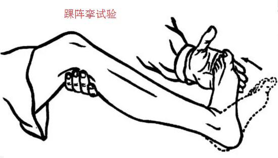踝阵挛试验