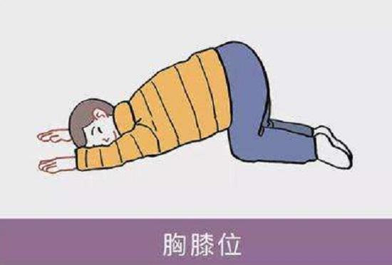 胸膝俯卧位