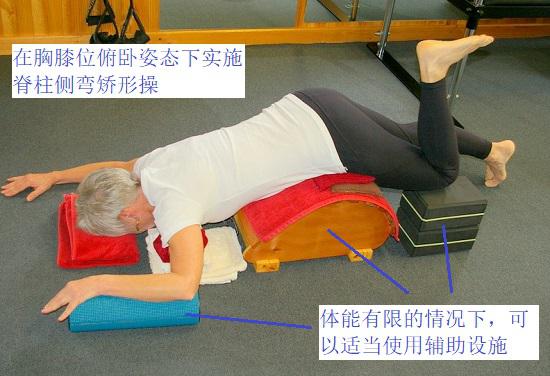 脊柱侧凸矫正体操