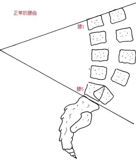 腰椎曲度