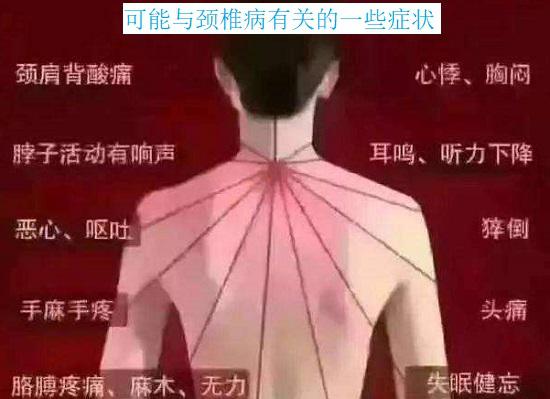 颈椎病可能引发的症状