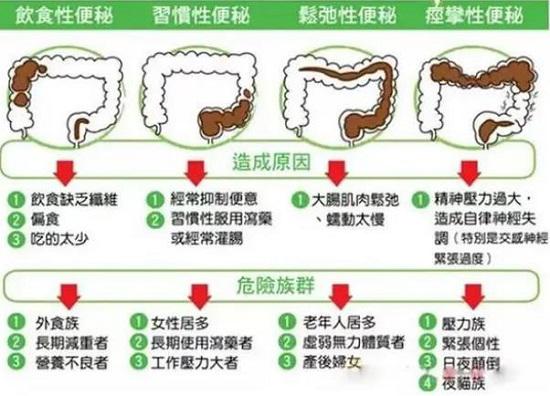 便秘的常见原因