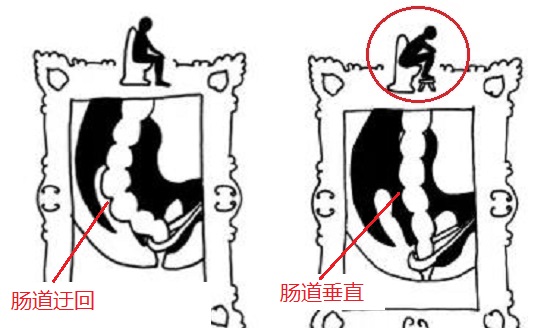调整排便姿势