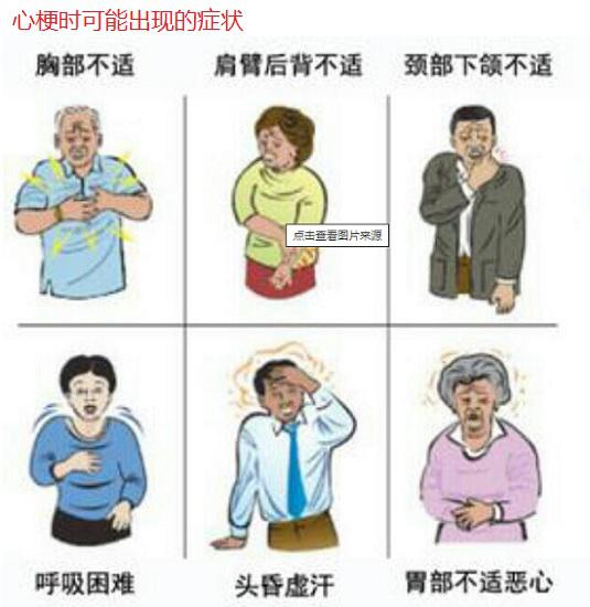 心梗时可能出现的症状