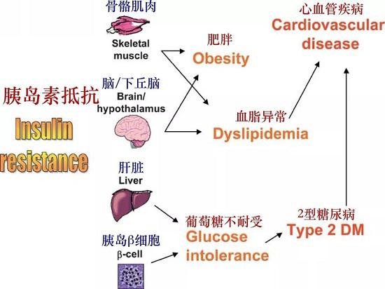 糖尿病与高血脂的关系