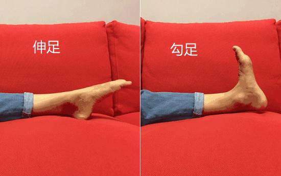 踝泵运动